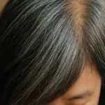 “새치가 늘어나는 이유? 몸이 스스로 면역 활성화 중이라는 연구 결과” 3 “새치가 늘어나는 이유? 몸이 스스로 면역 활성화 중이라는 연구 결과”