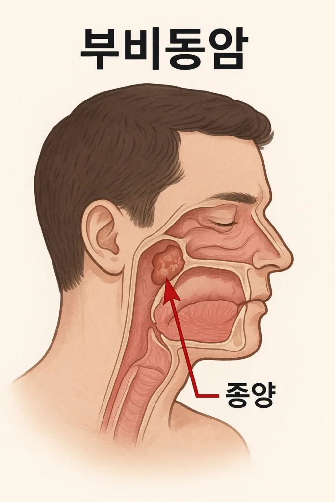 “콧물인 줄 알았다가… 부비동암이면 이미 늦다?” 조용히 진행되는 치명적 암의 경고 신호 4 “콧물인 줄 알았다가… 부비동암이면 이미 늦다?” 조용히 진행되는 치명적 암의 경고 신호